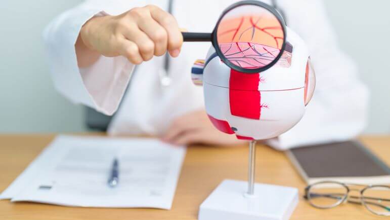 La DMLA humide se caractérise par le développement anormal de vaisseaux sanguins dans la macula.