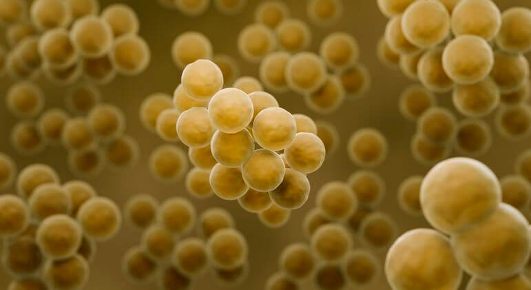 Staphylococcus aureus le plus souvent en cause.