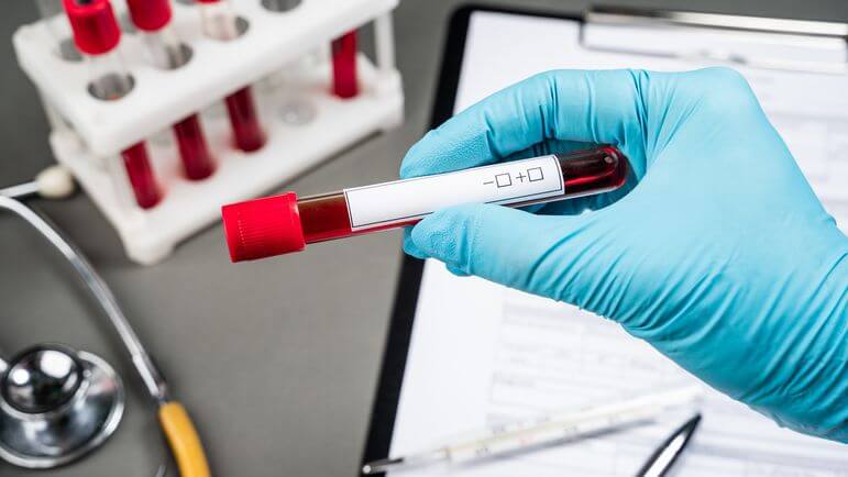 La lithiémie permet d’établir la posologie de TERALITHE LI.